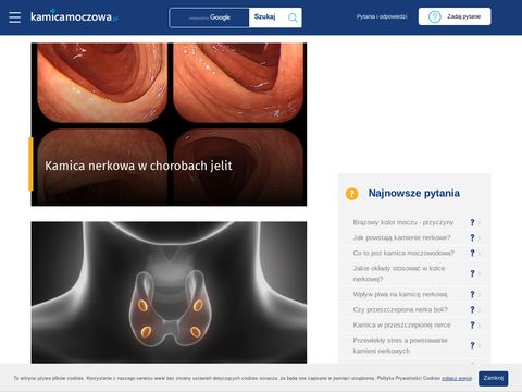 Kamicamoczowa.pl kolka nerkowa - leczenie